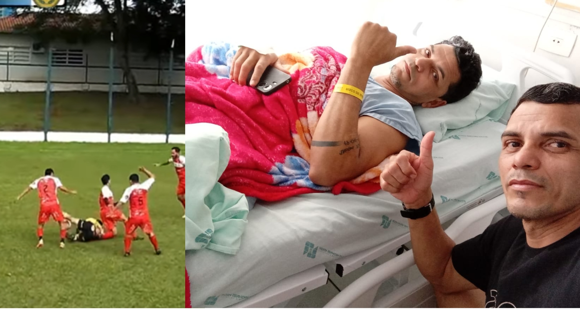 Jogador sofre grave fratura durante semifinal do Municipal de Futebol 7 em Medianeira